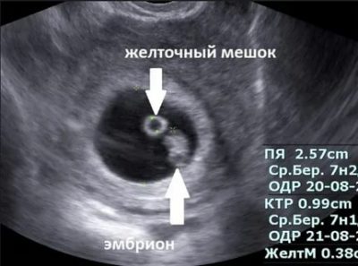 На каком сроке беременности на узи видно эмбрион