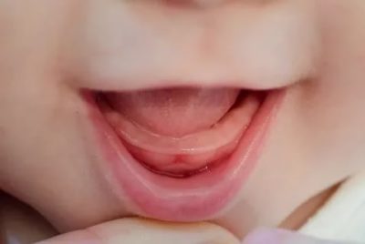 Когда у малыша появляется первый зуб
