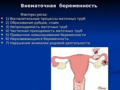 Как может возникнуть внематочная беременность