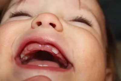 Сколько по времени лезет первый зуб у ребенка