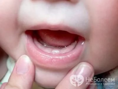 Когда у ребенка начинают резаться зубы