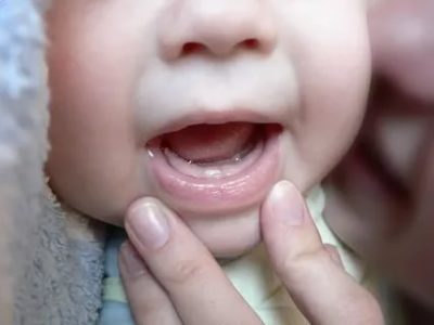 Сколько времени прорезается первый зуб у ребенка